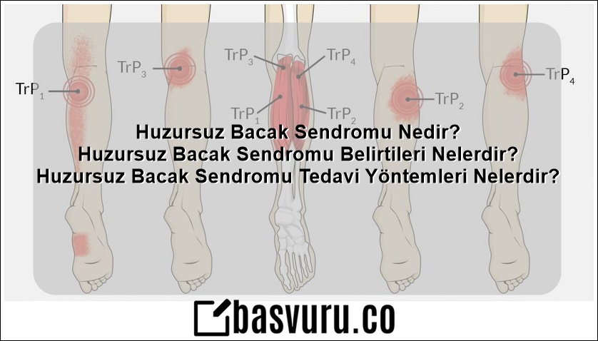 huzursuz bacak sendromu